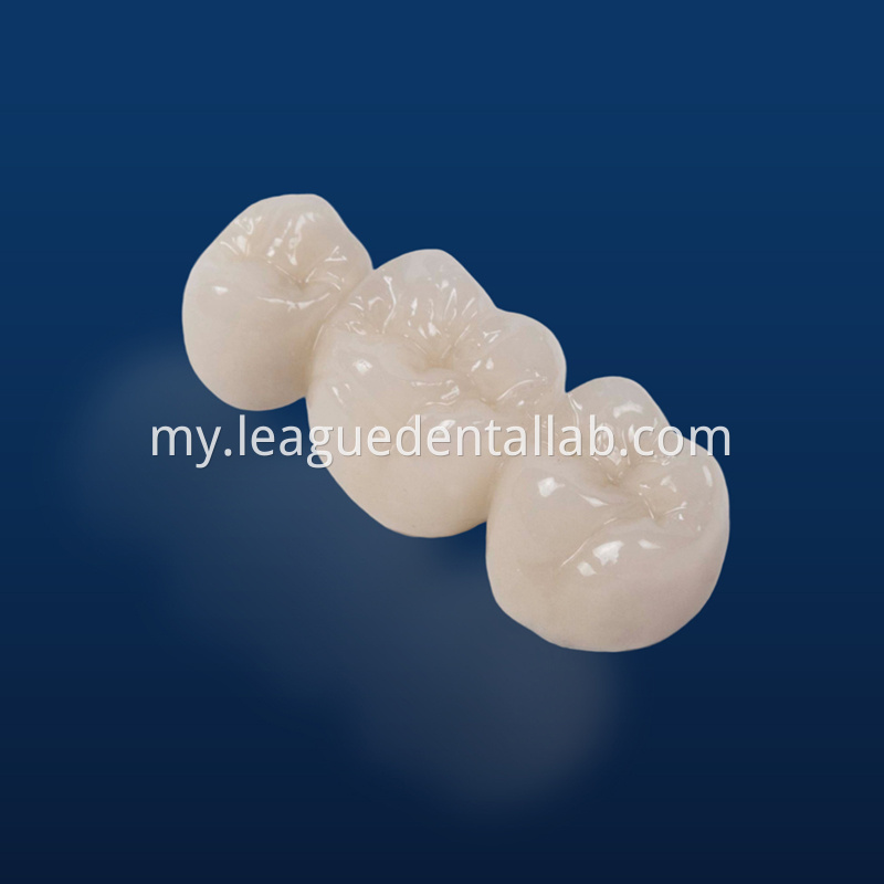 Full Zirconia crown,Full contour zirconia,Solid Zirconia,Zirconia,Monolithic Zirconia